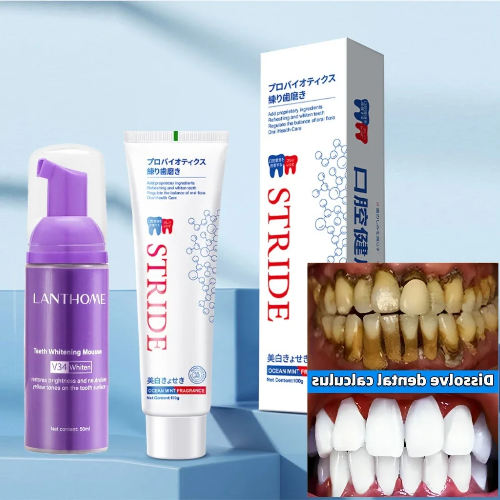 Dental Calculus Remover Whitening Teeth Mousse Toothpaste for Mouth Odour Removal Bad Breath Preventing Periodontitis dental calculus remover teeth whitening essence teeth whitening product