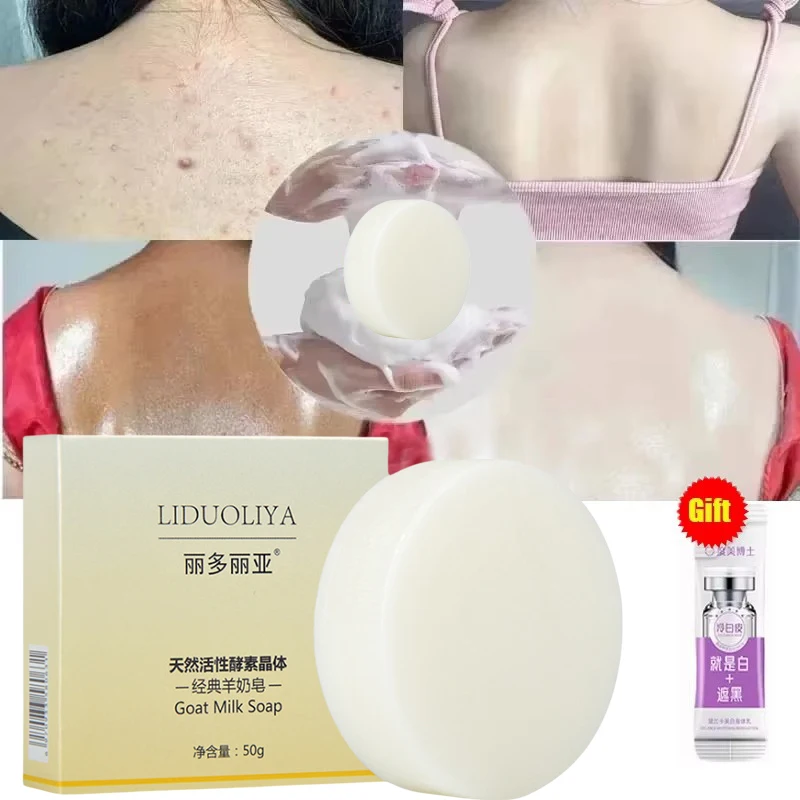 Body Whitening Soap Deep Clean Skin Chicken Skin Removal Soap Armpit Underarm Knees Bleaching Body Brighten White Care Products 1 Body Whitening Soap Deep Clean Skin Chicken Skin Removal Soap Armpit Underarm Knees Bleaching Body Brighten White Care Products 1