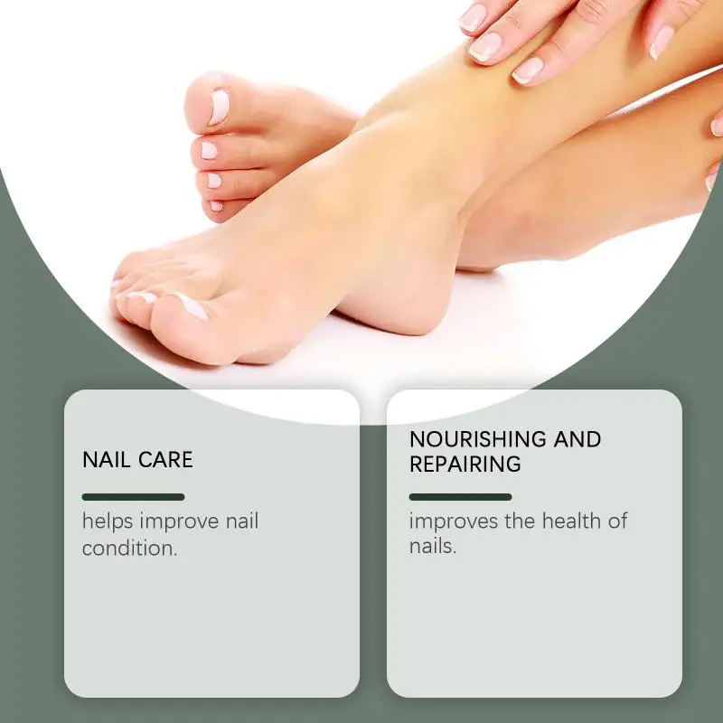 Soluzione Riparatrice per Unghie con Tea Tree e Zenzero, Nutriente per Cuticole, Anti-Infezione, Rinforzante per Piedi Danneggiati - immagine 3