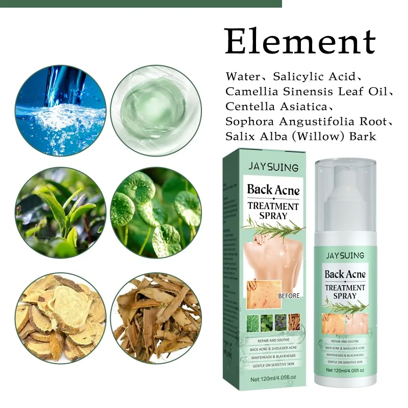Acne Cover Cream Back Acne Treatment Spray Moisturizing Repair Sooth Remove Whiteheads Blackheads Oil Control Pimples