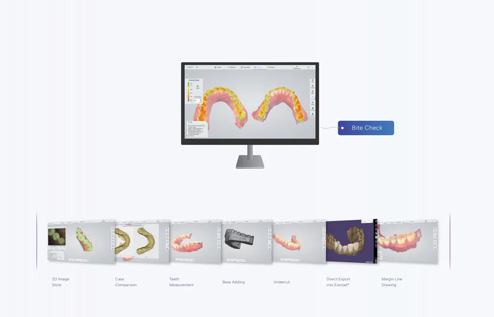 Рисунок 6 - Одобренный CE интраоральный 3D сканер