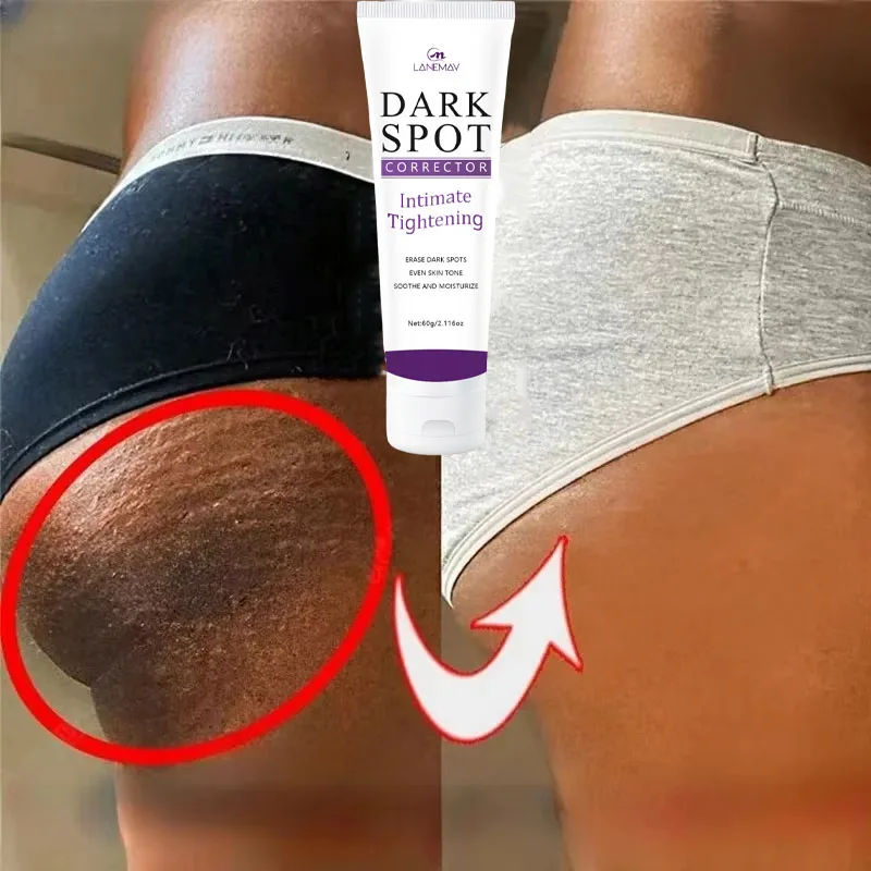 Body Lotion Cream Whitening Private Parts Underarm Butt Knee Inner Thigh Intimate Parts Remove Melanin
