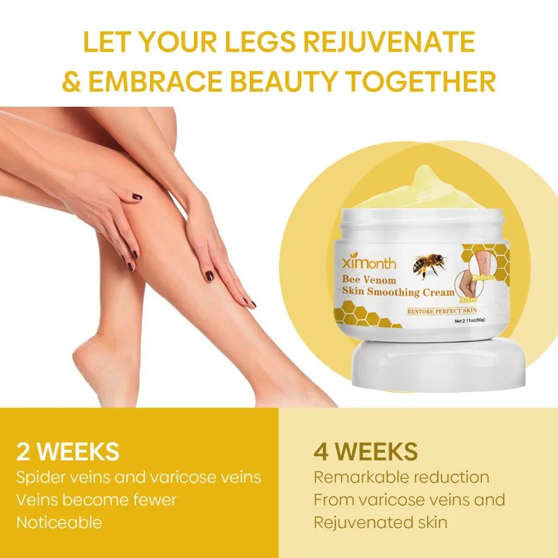 발톱무좀 Bee Venom Venous Repair Cream Relieves Leg Pain and Swelling Smoothes Vascular Protruding Veins Personal Health Care personal health care