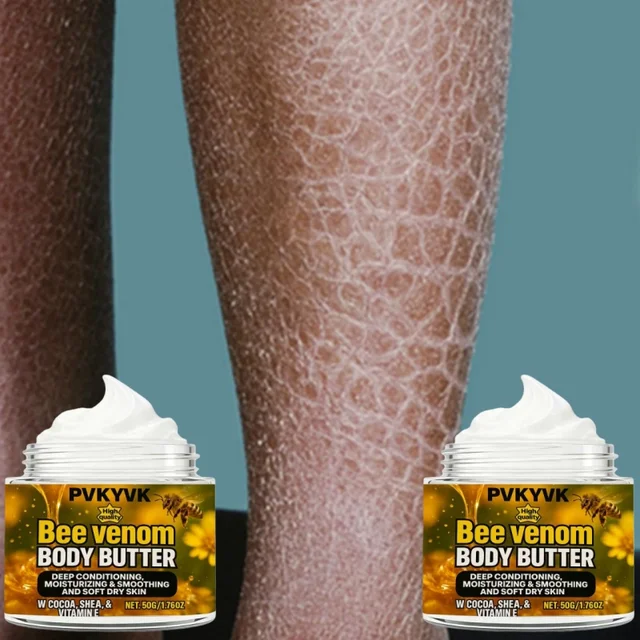 Crème pour le corps super hydratante Premium Bee Venom Convient à tous les types de peau avec peau craquelée et sèche sur les bras et les jambes 1
