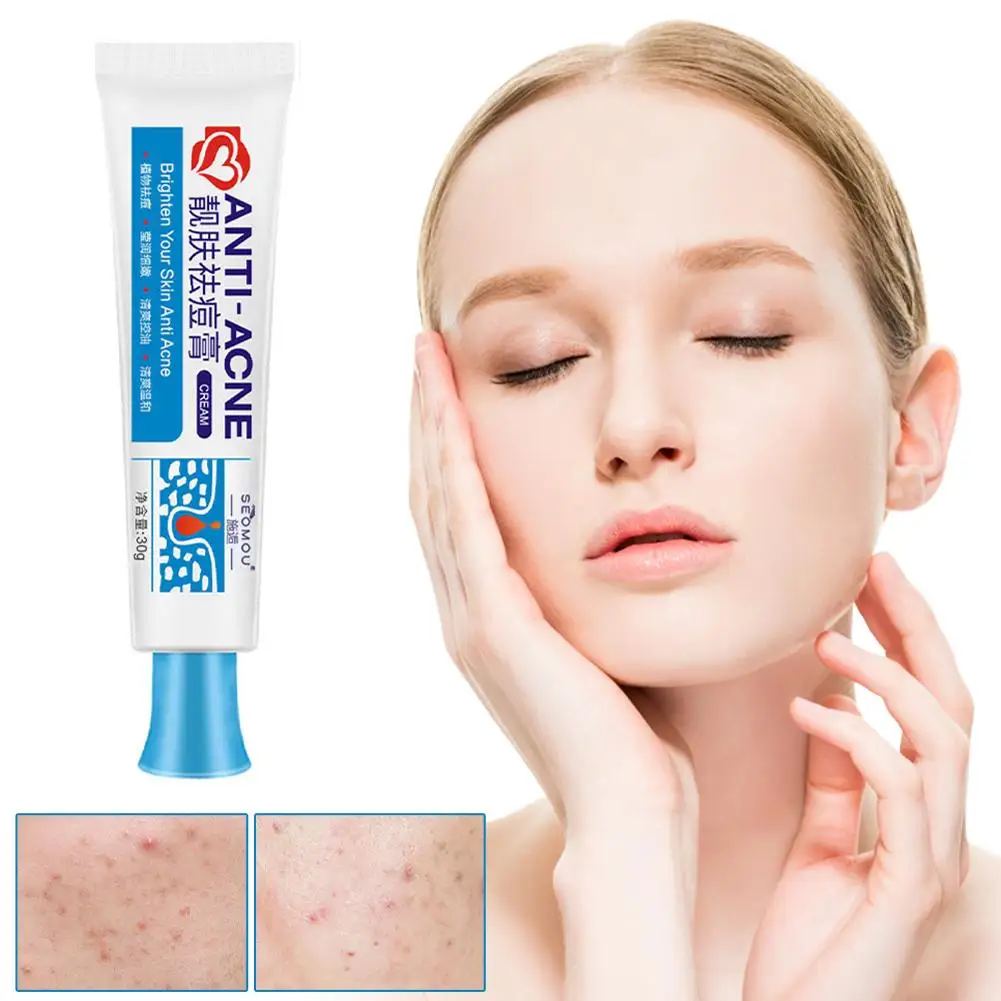 25g Acne Removal Cream Anti-Acne Gel Effective Treatment Pimple Spot Scar Blackhead Oil Control Moisturizer Skin Care