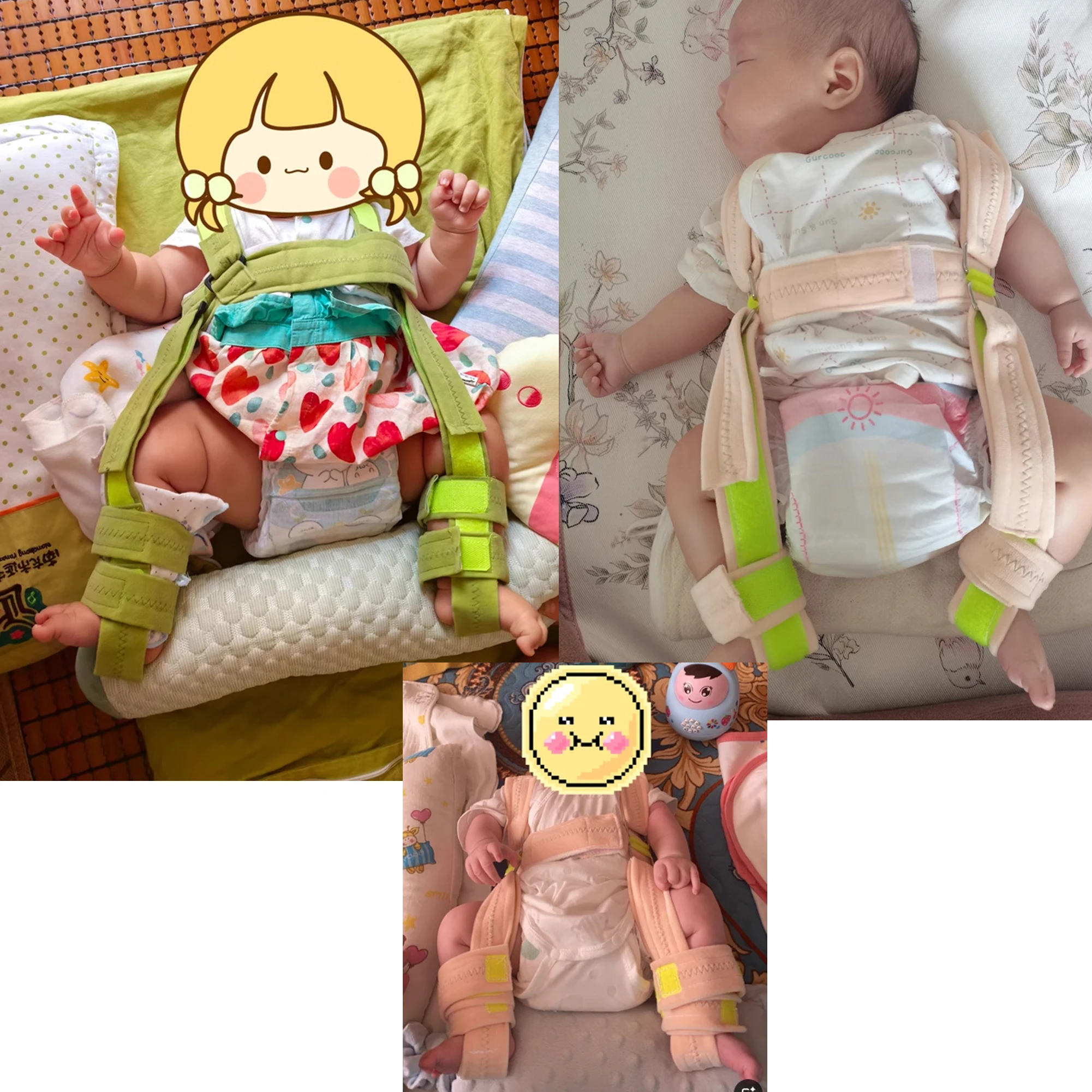 Pavlink Harness Orthosis Hip Joint Brace Children Pavlik Brace Hip Joint Baby Belt Fixation 5