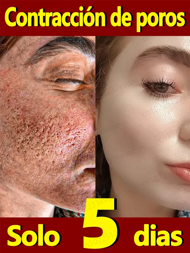 Pore shrinking serum for facial removal of large pores, firming and repair of large pores on face