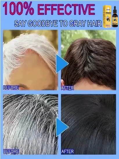 Tueur de cheveux blancs, &eacute;limine les cheveux blancs en 7 jours et restaure la couleur naturelle des