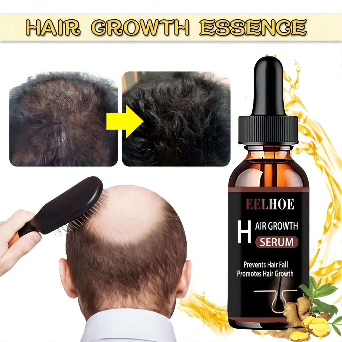 Fast Hair Growth Essence Oil Hair Nourishing Essential Oil Scalp Essence Conditioner 30ML Serum Anti Lost Beauty Products lost