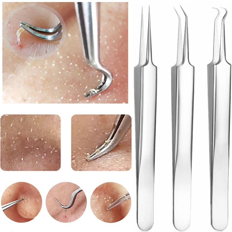 Stainless Steel Acne Clip Acne Needle Blackhead Removal Clip Whitehead Removal Needle Blemish Remover Tweezers Face Care  Tools