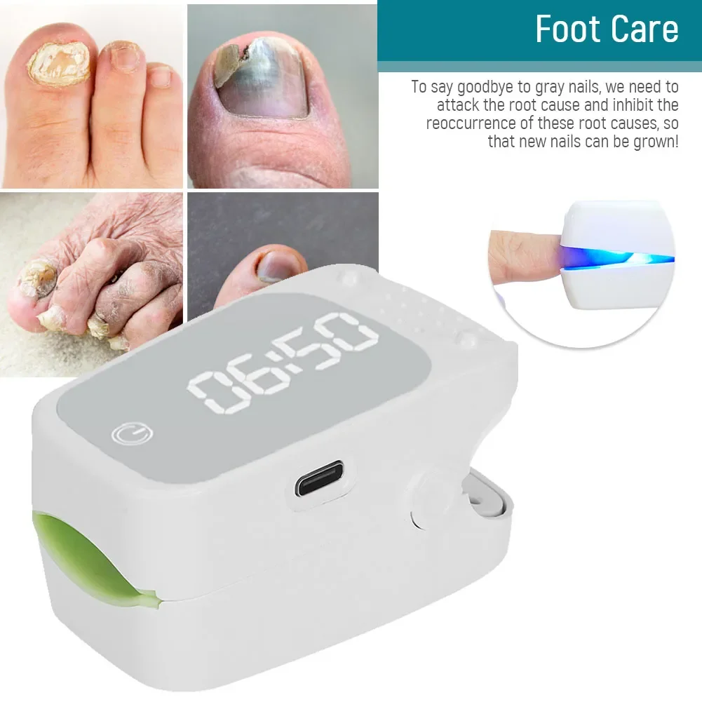 

905NM Nail Fungus Laser Nail Treatments Device USB Charging Light Therapy for Fingernails Toenails Onychomycosis Cure Machine