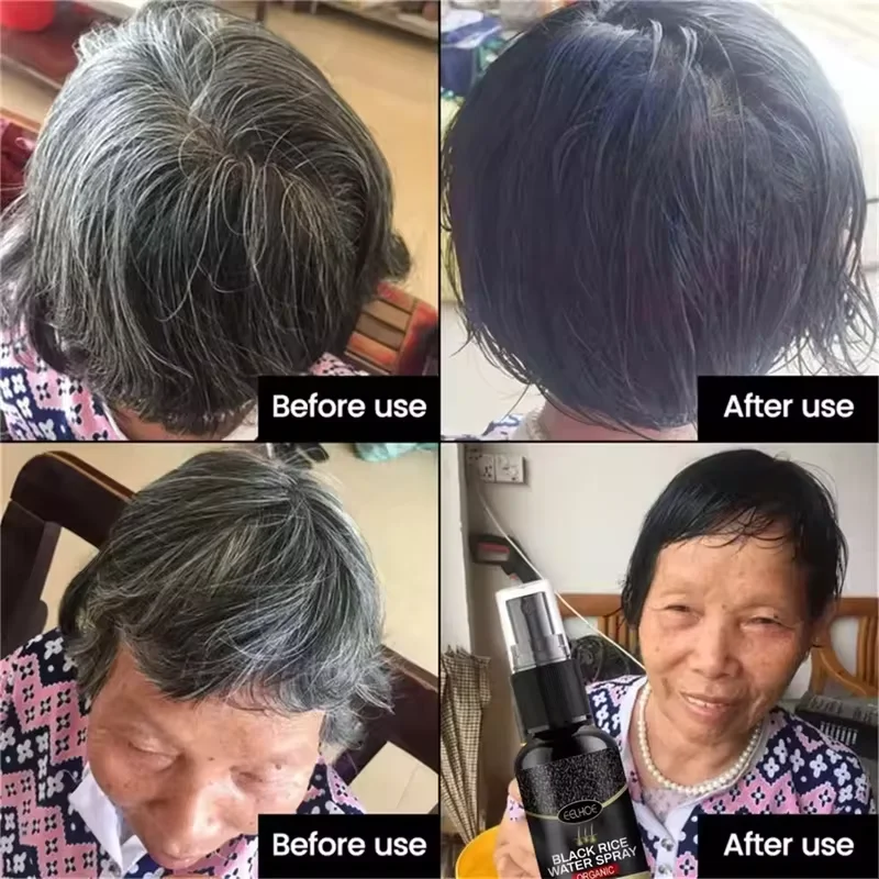 Copertura del siero per il trattamento dei capelli bianchi grigi Capelli bianchi al spray riparatore del colore naturale nero Anti perdita dei capelli Ripristina la salute - immagine 3