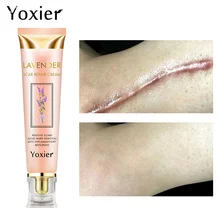 

Yoxier Lavender Scar Repair Cream Acne Scar Stretch Marks Pigmentation Corrector Anti-allergic Calm Whitening Skin Care 20g