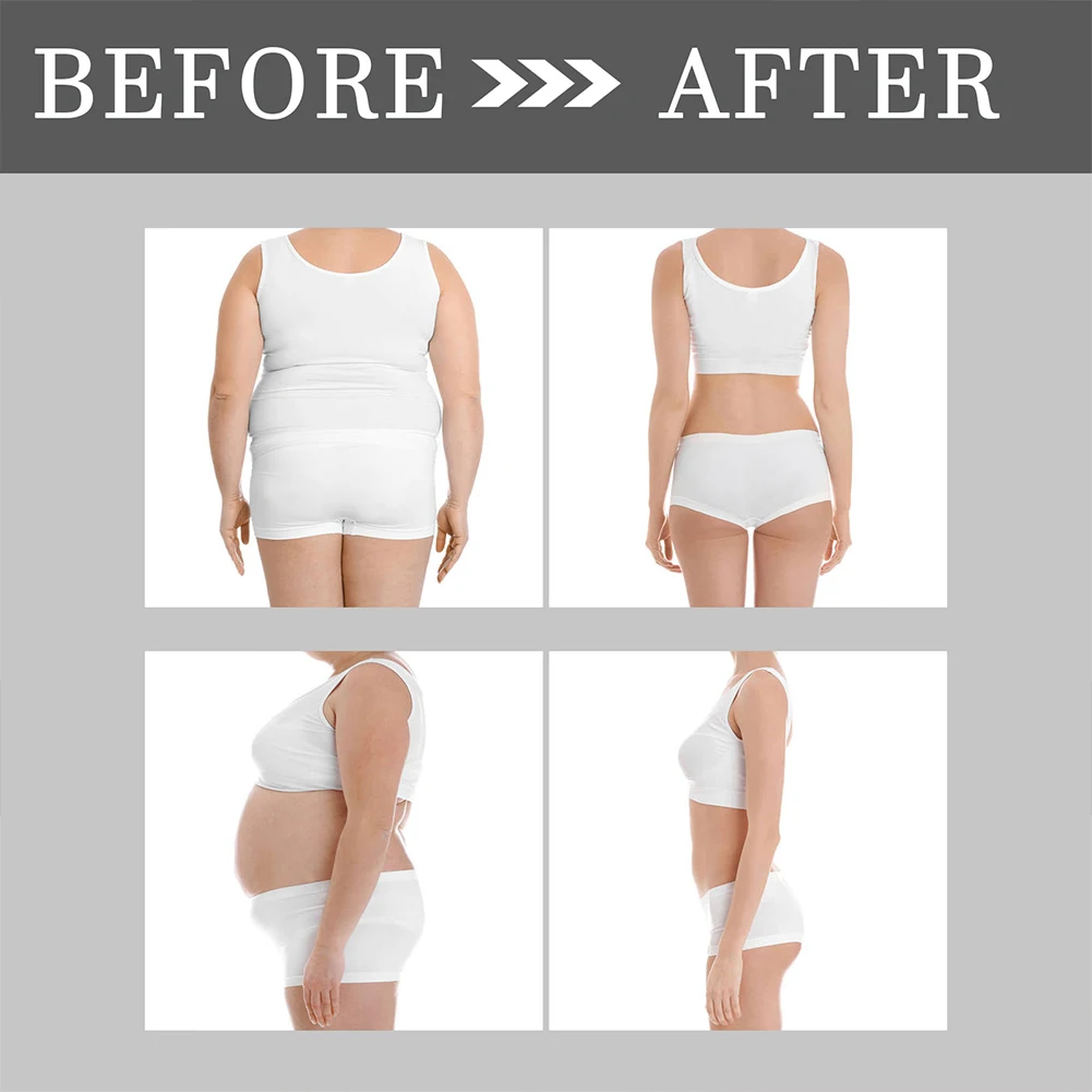 10Pcs/Bag Weight Loss Belly Slimming Patch Relieve Stress Lymphatic Drainage Patches Detox Abdominal Navel Sticker for Women Men