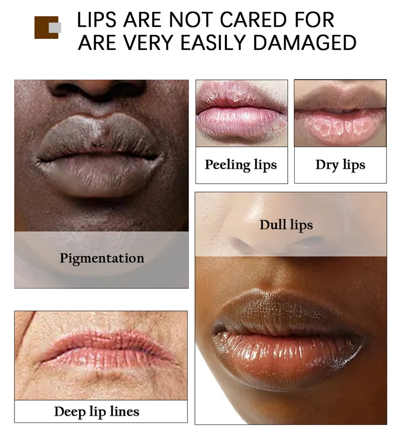Lip Lightening Scrub Balm Remove Dark Smoke Lips Exfoliating Repair Fine Lines Hyaluronic Acid Moisturizing Brightening Lip Care