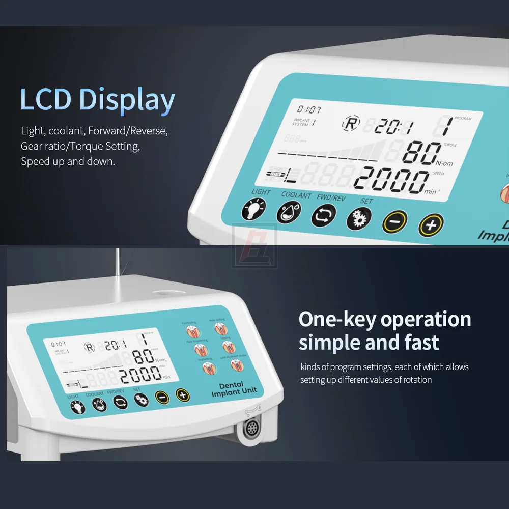 Рисунок 4 - Мотор для зубного импланта