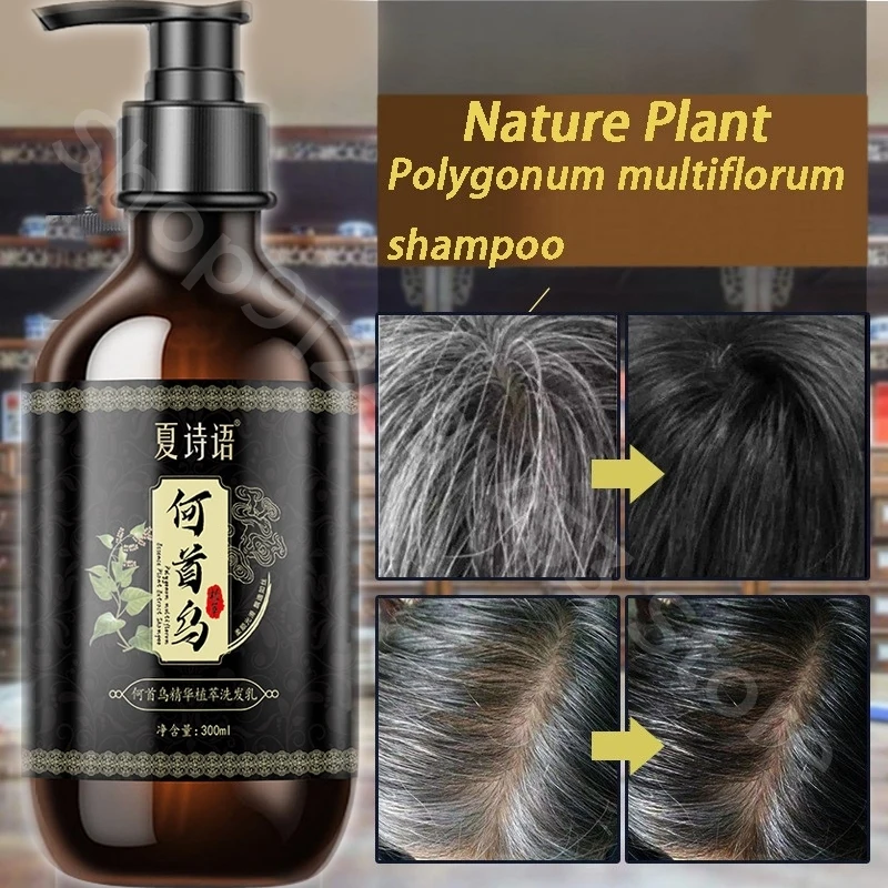 Black Ganoderma and Polygonum Multiflorum Plant Shampoo Repairs and Nourishes Damaged White Hair and Turns It Into Black Hair 2