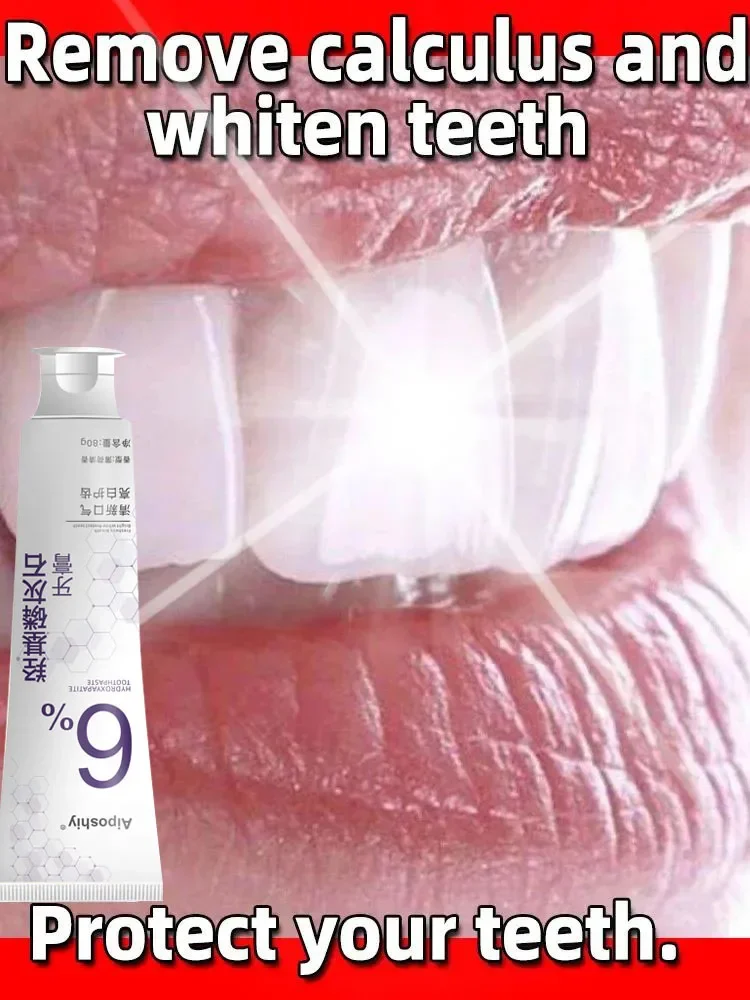 Dental Calculus Remover Teeth Whitening Product Mouth Odor Removal Bad Breath Preventing Periodontitis