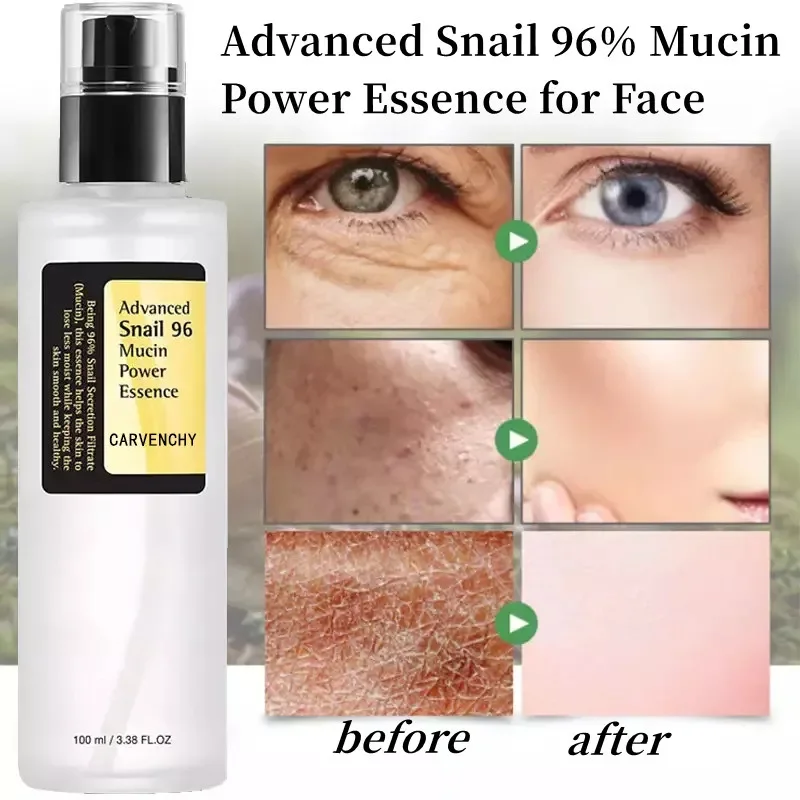 Snail Mucin 96% Power Repairing Essence,Hydrating Face Serum Shrink Pores Acne Treatment Dark Spots Fine Lines,Facial Skin Care