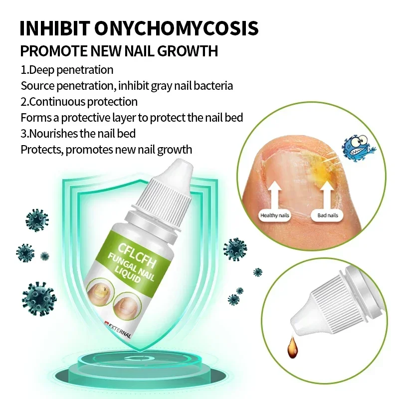 Nail Fungus Treatment Oil Onychomycosis Repair Removal Paronychia Foot Toe Toenail Nail Fungal Repair Care Liquid