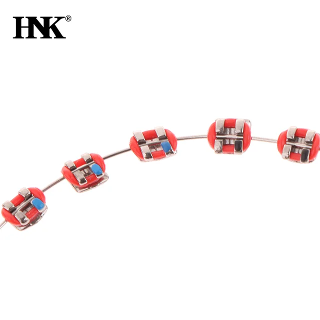 Temporary Tooth Decoration With Metal Wires Colorful Metal Bracket And Orthodontic Ligature Ties Dental Decorations