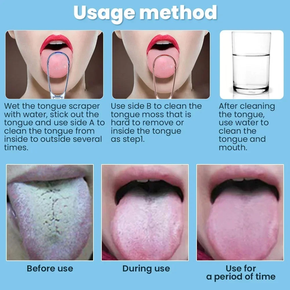 Ashowner Tongue Scraper Tongue Cleaner Bad Breath Removal Fresh Breath Cleaning Coated Tongue Scarper Brush Oral Care Tools