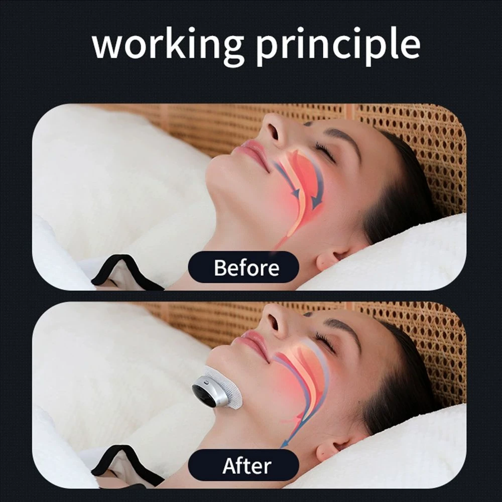 Smart Anti Snoring Device Stop Snoring Dual Pulse Muscle Stimulator Anti Sleep Breathing Corrector Health Care