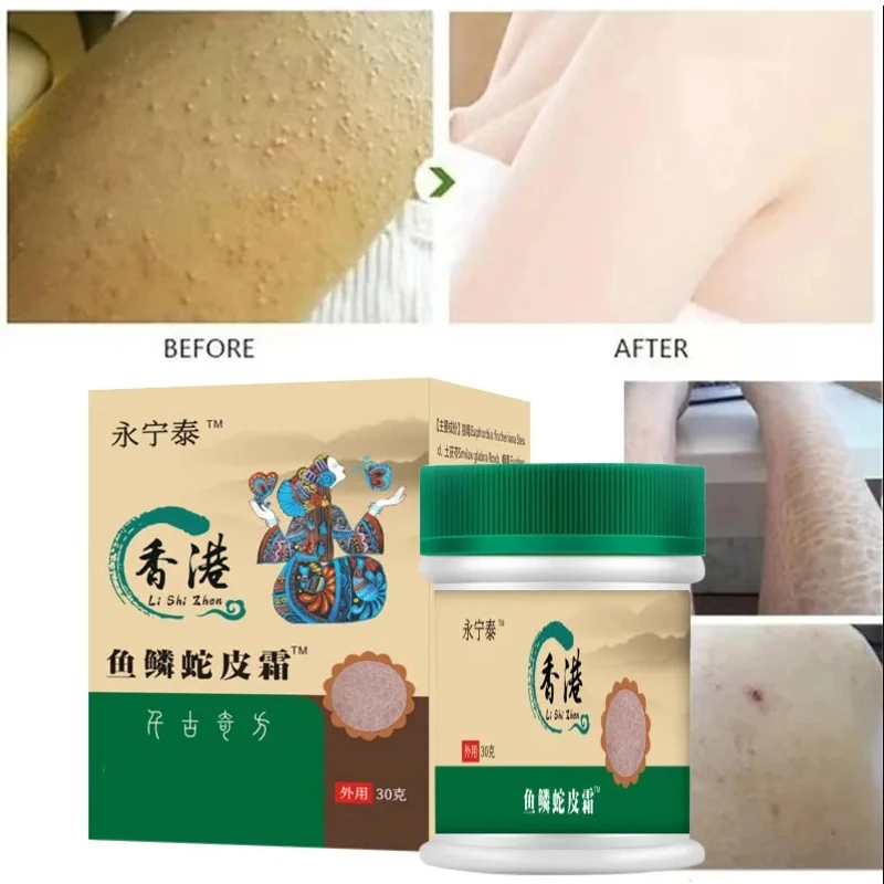 إزالة غسول الجسم لبشرة الدجاج ، وتحسين المسام ، وإ...