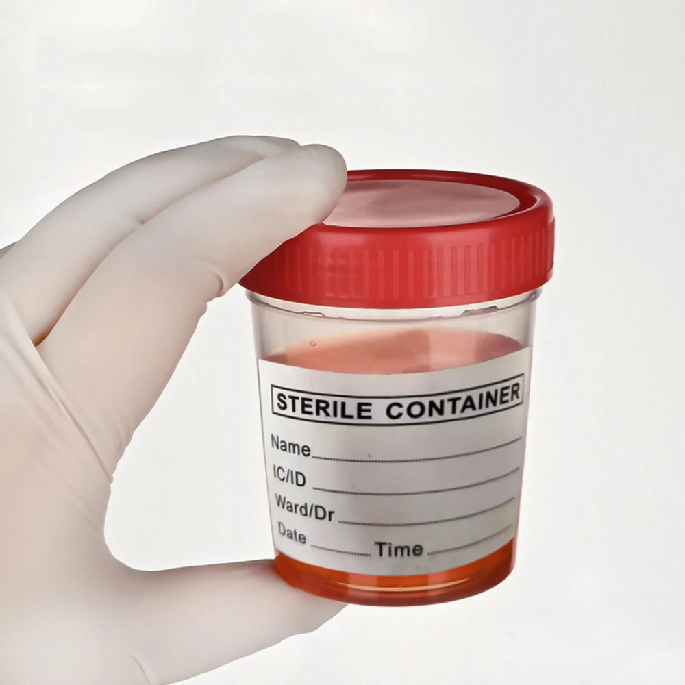 5pcs Urine Collection Sample Cup Specimen Bottle Container 60ML Plastic Cup Container for Use Disposable Urine