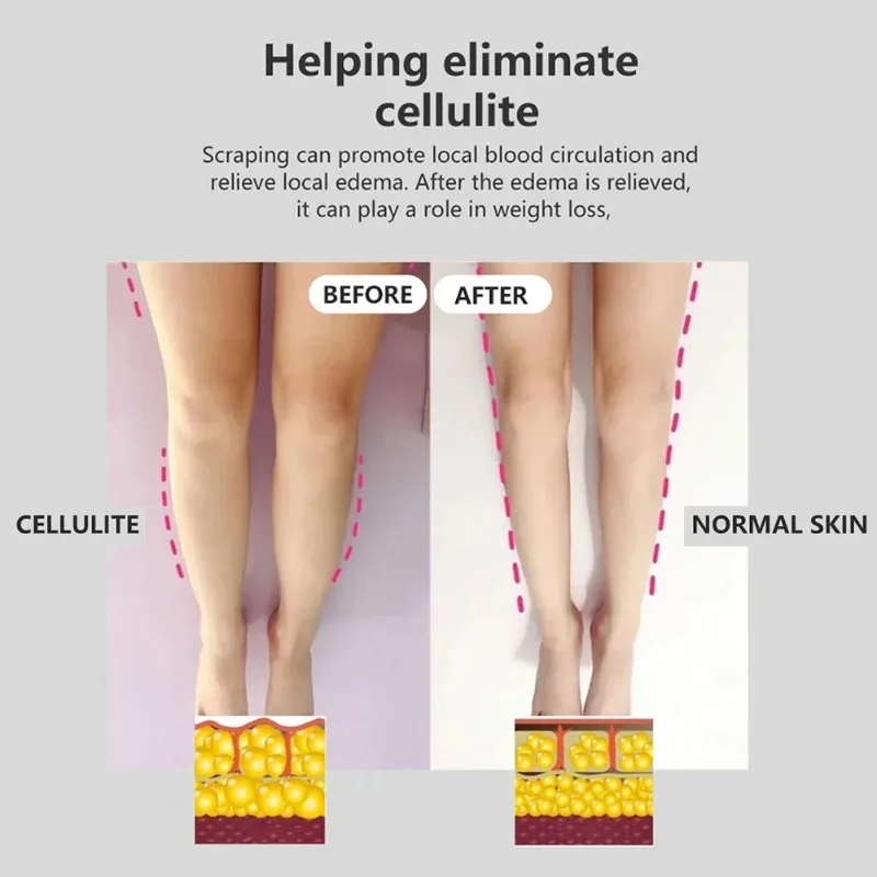 Electric Guasha Scraping Cupping Massage LCD Display EMS Body Massager Vacuum Cans Suction Cup IR Heating Slimming Instrument