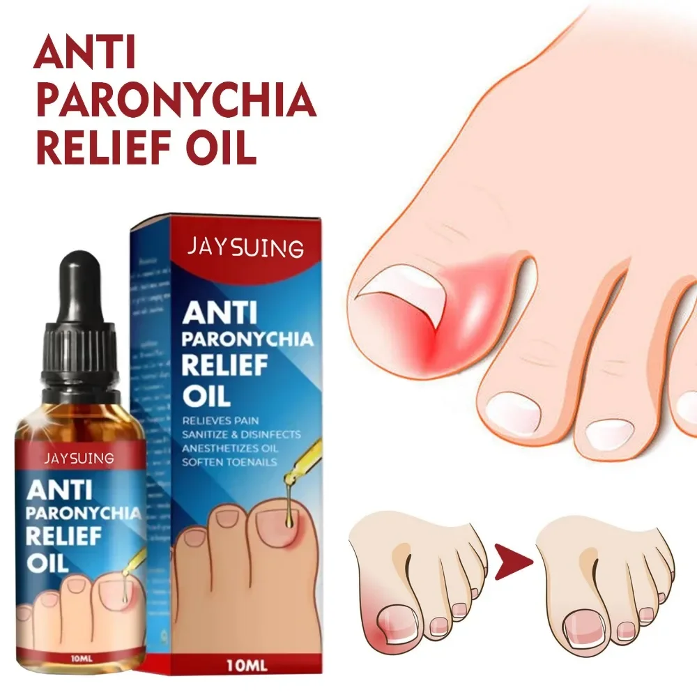 10ml Paronychial Sulcus Nursing Oil Repair Ingrown Armor Grey Nails Paronychial Sulcus Relieve Soft Armor Bright Nursing