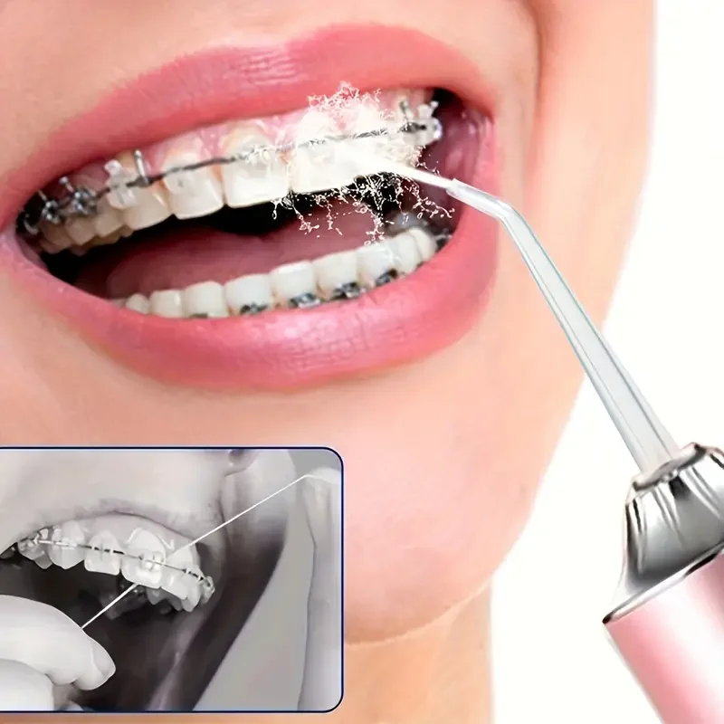 USB-Powered Dental Water Jet Pick for Teeth Cleaning