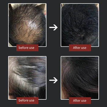 Hair Fibers Application Comb - Tool for Hair Loss Concealment & Hairline Thickening