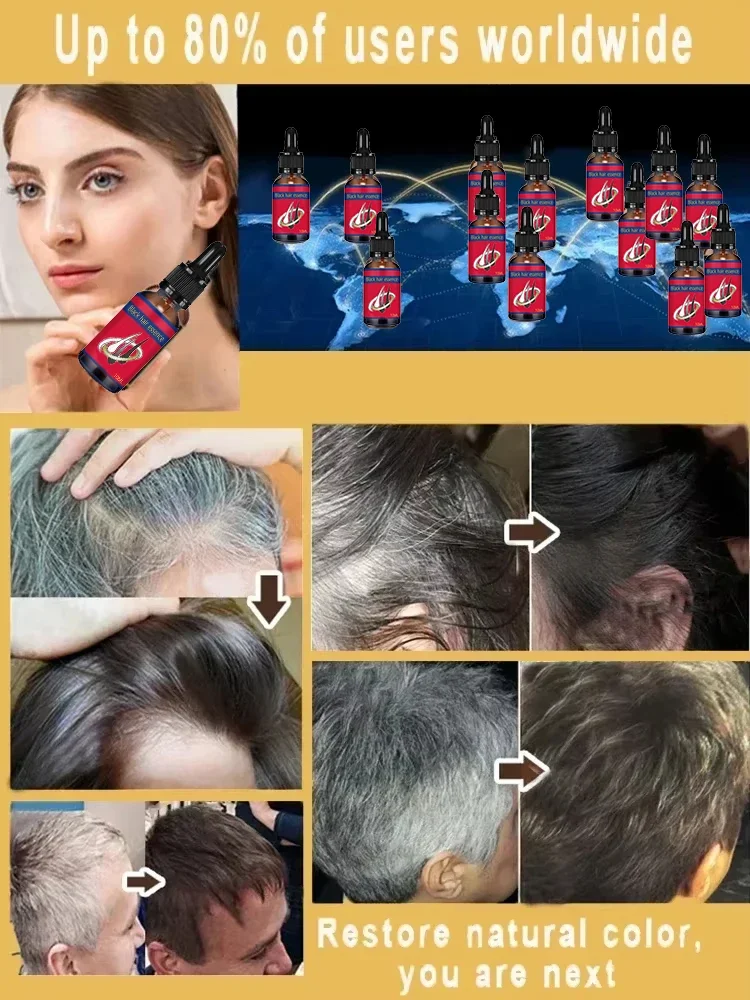 Se d&eacute;barrasser des cheveux gris et restaurer vos cheveux naturels document: Les meilleurs produits pour gris de