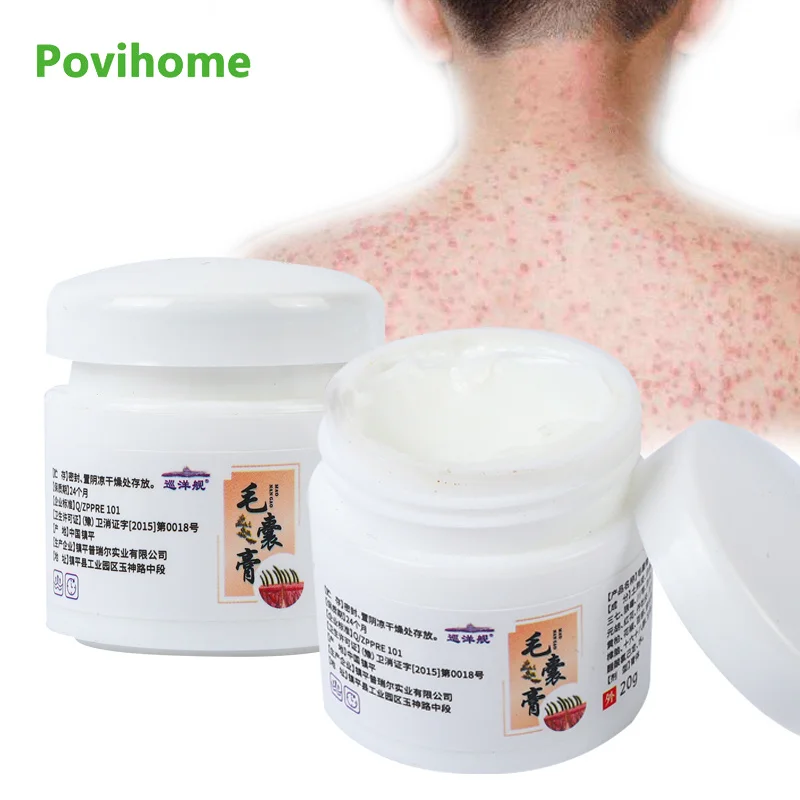 

20g Herbal Folliculitis Antibacterial Cream Anti-Itching Remove For Body Acne Itching Skin Cure Care Anti Inflammation Cream