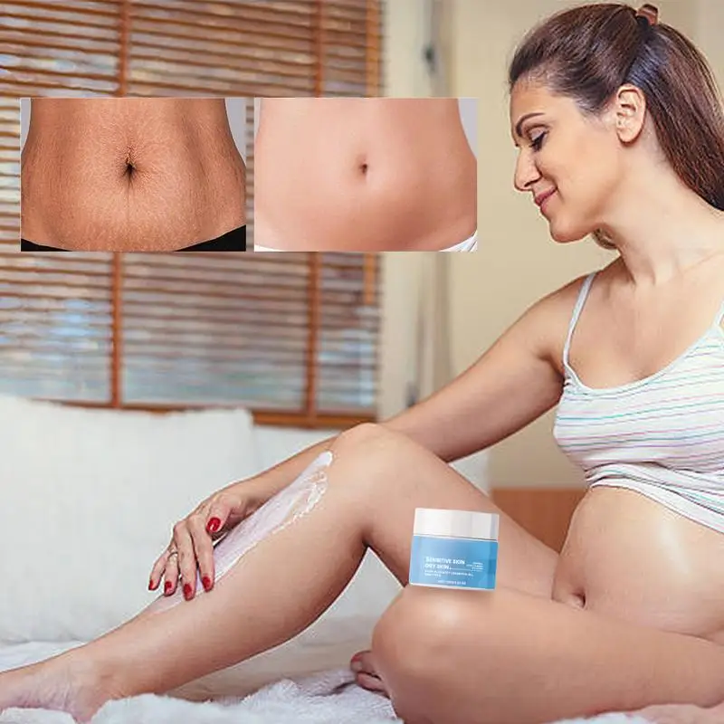 

Крем Для Удаления растяжек и шрамов, 100 г