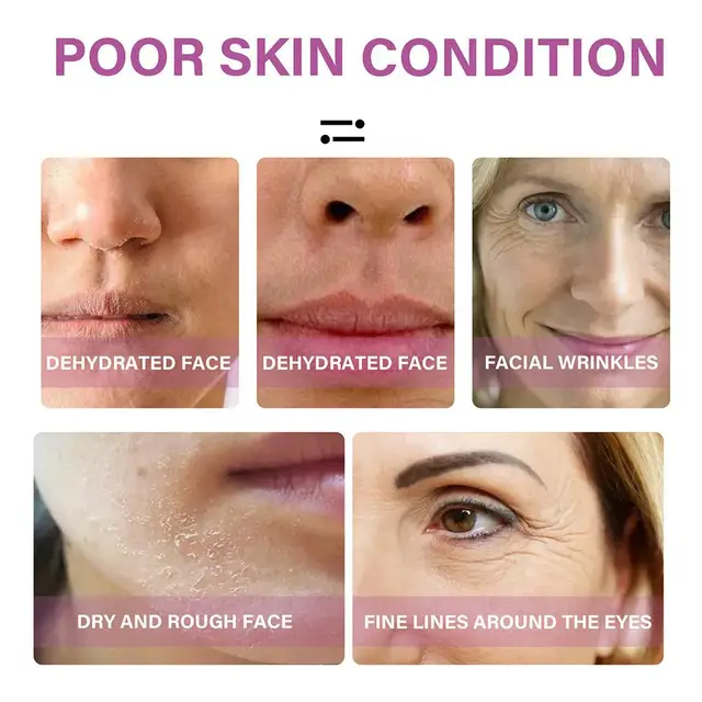 Hyaluronic Acid Lift Firming Ampoule Facial Serum Brightening Anti-Wrinkle Moisturizing Retinol Skin Lightening Collagen Serum 4