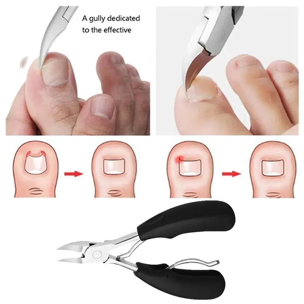 Professional Nail Scissors Set-Toenail Clippers Ingrown Nail Cutter Cuticle Nipper & Dead Skin Remover for Pedicure/Manicure