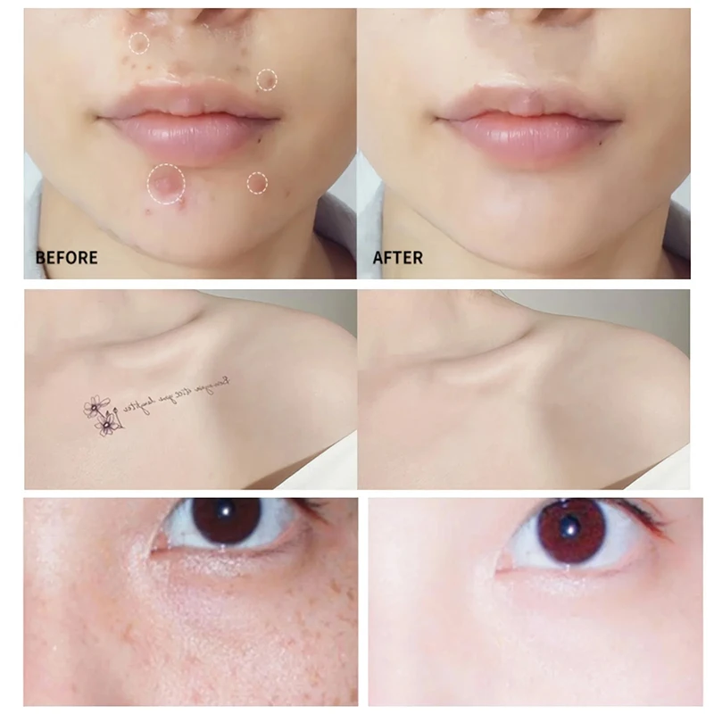 3 Colors Body Concealer Waterproof Long Lasting Cover Up Scars Dark Spots Freckles Cream Tattoo Covering Concealer Makeup Cream 2