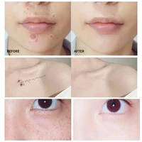 3 Colors Body Concealer Waterproof Long Lasting Cover Up Scars Dark Spots Freckles Cream Tattoo Covering Concealer Makeup Cream 2