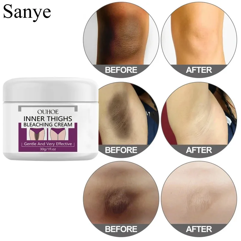 Dark Skin Whitening Cream Body Underarm Bleaching Emulsion Armpit Butt Whiten Cream Woman Knee Remove Melanin Skin Brighten Care