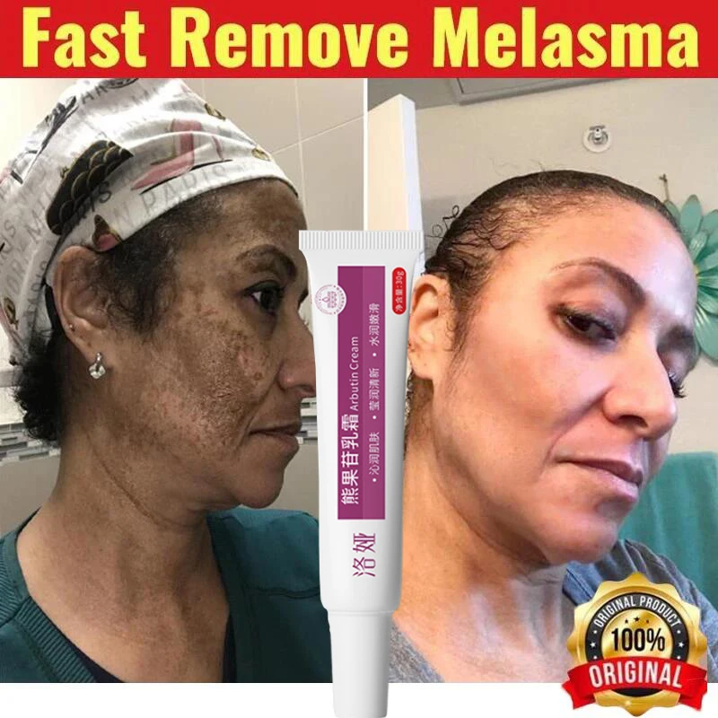 Face Dark Spots Remover Effective Whitening Remove Melasma Freckles Cream Removal Melanin Skin Brightening Face Care Products