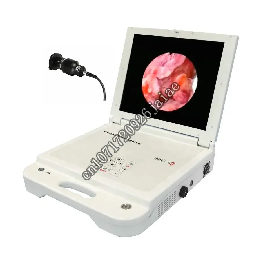 

Portable laparoscopic endoscope endoscopy system arthroscopy hd