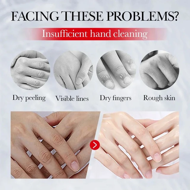 Kojic Acid Anti-wrinkle Hand Cream Skin Soften Nourish Anti-drying Whitening Moisturizing Korean SkinCare Cracked Repair Product 6