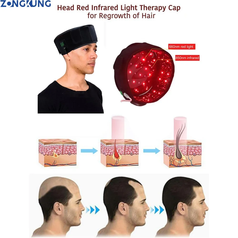 Gorro de terapia infrarroja con luz roja, tratamiento de Alopecia seborreica, Areata, crecimiento del cabello, dispositivo de sombrero para el crecimiento del cabello rojo, 70 piezas, 635nm y 850nm