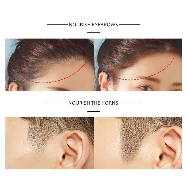 Disaar Professional Shampoo for Regrowth Anti Hair Loss Chinese Hair Growth Product Prevent Hair Treatment for Men & Women