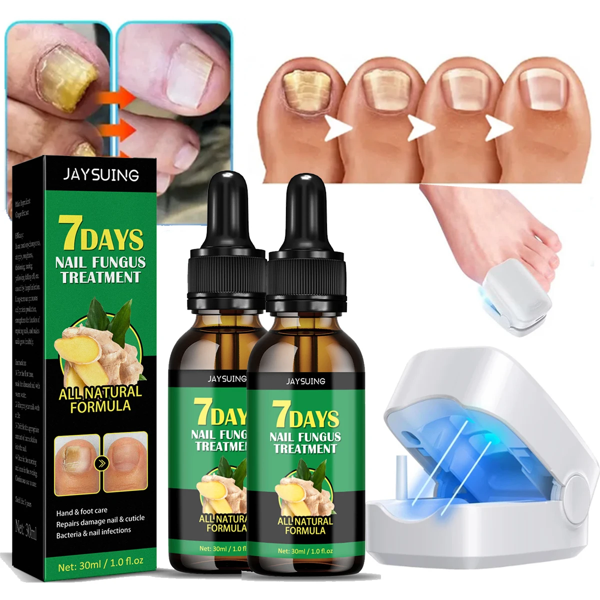 Ingrown toenail treatmenttoe nail fungus treatmentstoe fungus treatment for toenailherbal