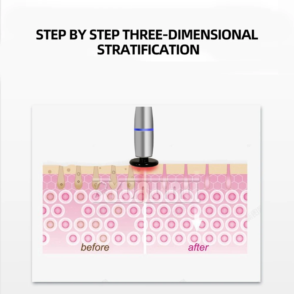 جهاز التجميل