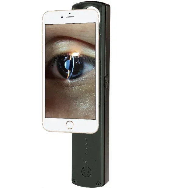 

Holyavision Slit lamp S150 Ophthalmic Advanced Portable Digital handheld