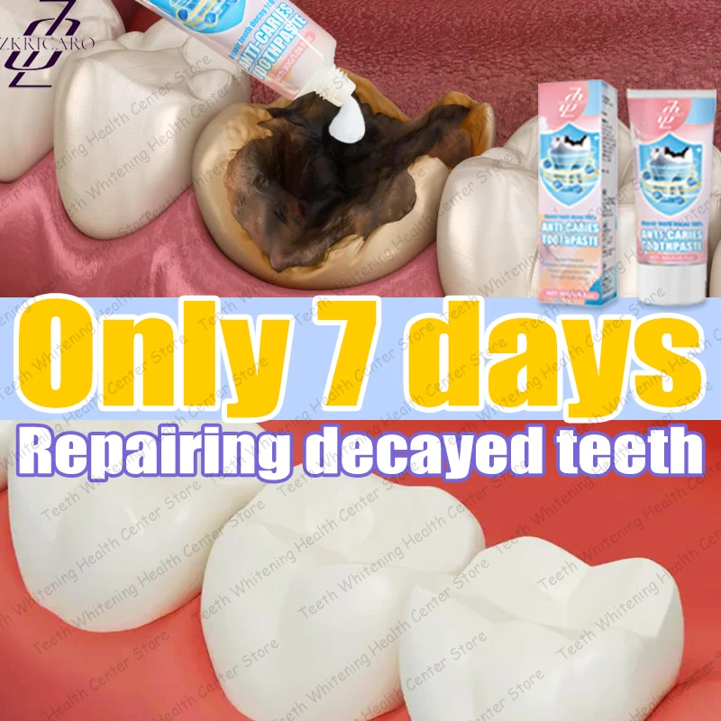 Tooth Decay Repair New Technology Efficient Repair of Tooth Decay